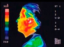 El principal problema en la salud y efecto biológico de la radiofrecuencia sobre las personas, es el efecto térmico, ya que produce un calentamiento de los tejidos al tener próximos a nosotros, las fuentes de este tipo de radiación son por ejemplo, los teléfonos móviles. El ICNIRP y la OMS, los han catalogado como posiblemente cancerígenos. El uso cada vez más extendido del teléfono móvil hace difícil imaginar la vida sin él, pero desde Hábitat Sano te damos estos consejos, siempre que hables por el teléfono, que sea con auriculares por cable (NO INALÁMBRICOS), no lleves el móvil pegado al cuerpo (Si miras las instrucciones del teléfono, pone que no tienes que tenerlo más cerca de x centímetros...), puedes usar fundas especiales de apantallamiento para ello. ¿Hablamos? www.habitatsano.com