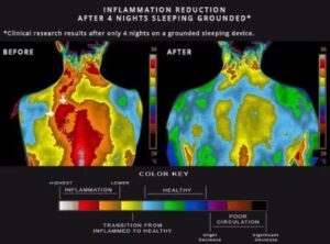 sabana earthing grounding